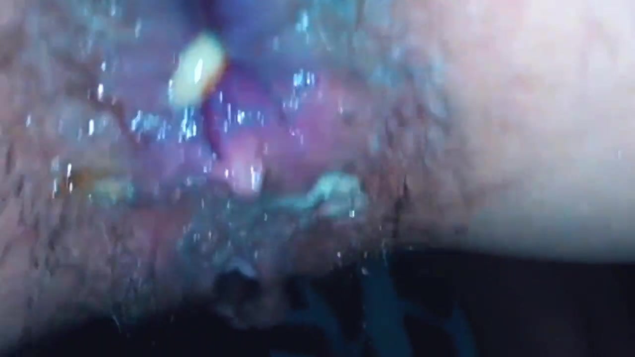 HAIRY GAPING ASSHOLE COMPILATION, HOMEMADE