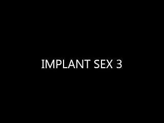 Cumshot, Implants, Creampie, Creampied
