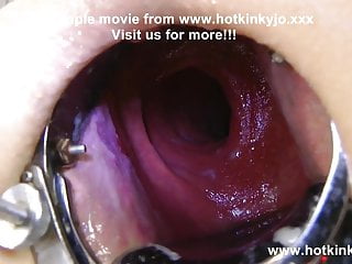 Speculum, Bulgings, Hotkinkyjo, Inserted