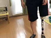 Japanese SAK amputee girl walking with prosthesis