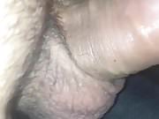 hairy anal