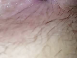 Hairy, Analed, Wifes Pussy, Hairy Ass Pussy